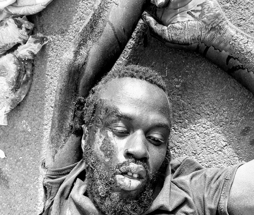 FANAYE: un homme mortellement  »percuté »